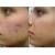 Аппарат для вакуумной чистки лица Power Perfect Pore - Чистая Кожа